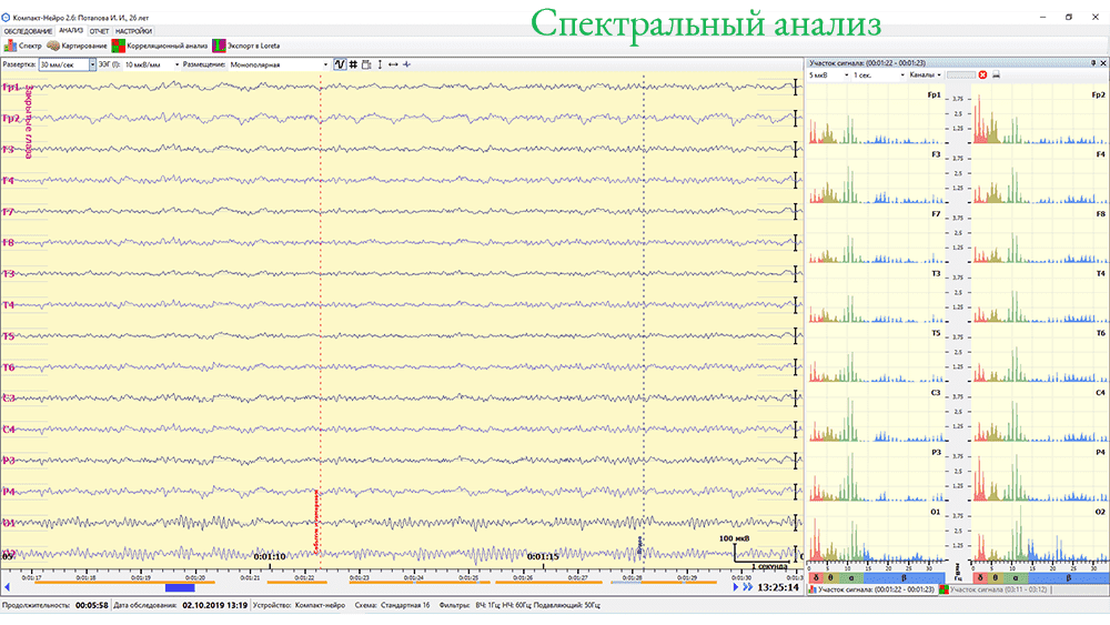Спектральный анализ - электроэнцефалограф Компакт Нейро 24 канала